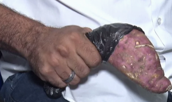 Se deu mal! ‘Zé Batata’, suspeito é preso por usar uma batata doce como arma