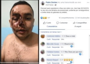 Vereador de Tavares-PB leva surra e acusa equipe da prefeitura