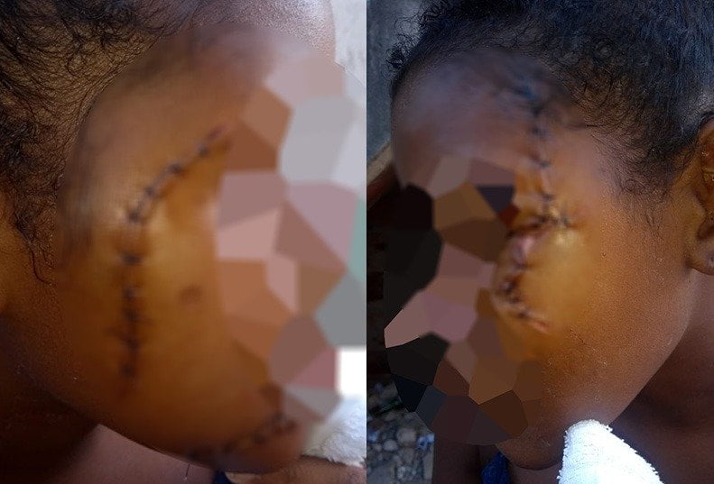 Estudante de 14 anos tem rosto desfigurado por golpes de estilete