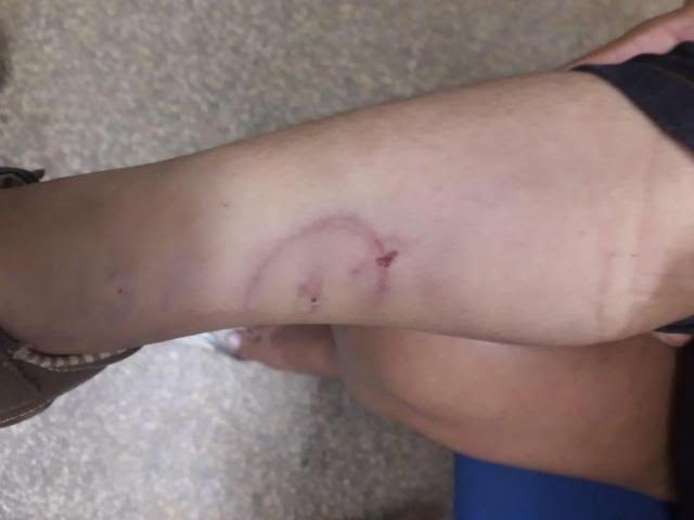 Criança de 3 anos foi torturada pelo padrasto por fazer xixi na cama