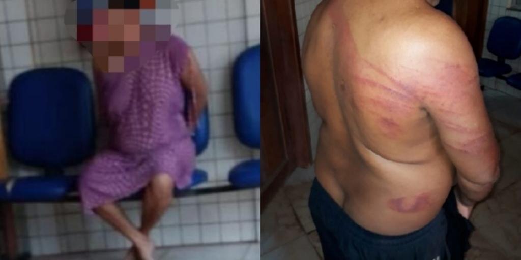 Mulher é presa por bater em esposo com facão