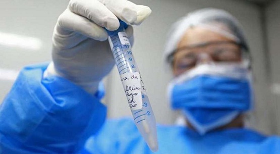 Anvisa libera testes de vacina chinesa contra o novo coronavírus