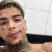 MC Kevin morre no Rio após cair do 11º andar de hotel na Barra da Tijuca