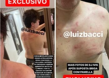 Justiça nega liberdade provisória e relaxamento de prisão de DJ Ivis; imagens do artista ferido são divulgadas