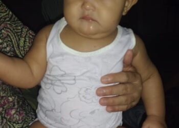 Iguaracy: Bebê de 1 ano e 6 meses ingere veneno de matar mosca e morre na tarde deste Sábado