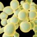 Anvisa confirma surto do superfungo Candida auris no Hospital da Restauração