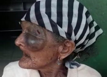 Homem espanca idosa de mais de 100 anos em Iaçu, na Bahia