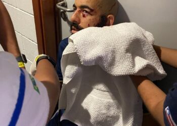 Ônibus do Bahia é atingido por bomba na Fonte Nova, antes de pegar o Sampaio; jogadores ficam feridos