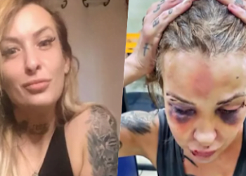 Mulher é torturada com soco inglês e cassetete por 3 dias pelo namorado