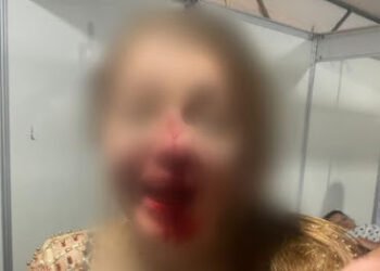 Advogada é agredida após se recusar a dançar forró com homem em festa