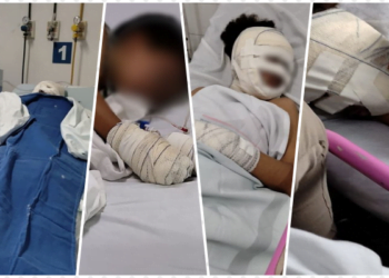 Em Pernambuco, quatro pessoas ficam feridas após explosão de gás de cozinha