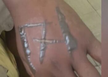 Funcionários acusam patrões de tatuarem ‘171’ no corpo deles usando ferro quente