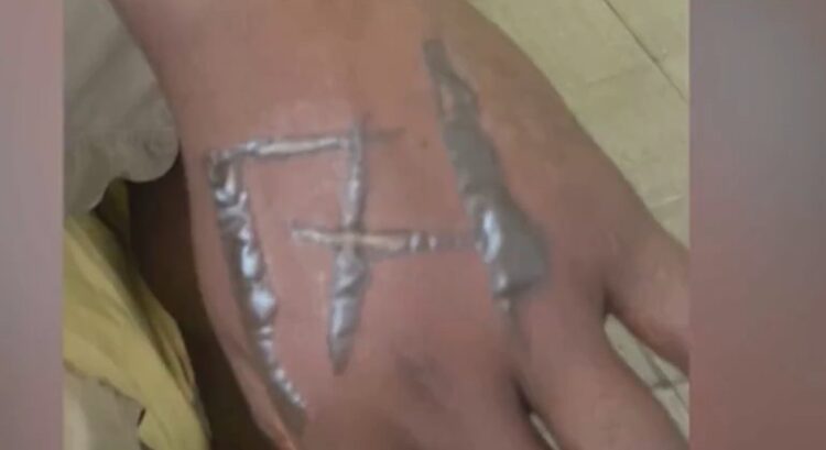 Funcionários acusam patrões de tatuarem ‘171’ no corpo deles usando ferro quente