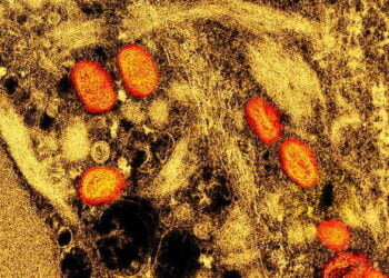 OMS dá novos nomes às variantes do vírus monkeypox, causador da varíola do macaco