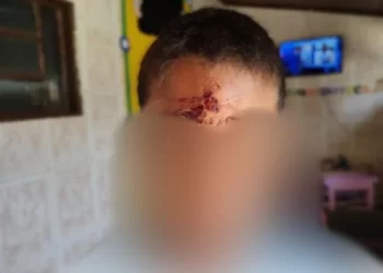Mãe apedreja filho de 7 anos na testa e acaba presa