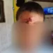 Mãe apedreja filho de 7 anos na testa e acaba presa