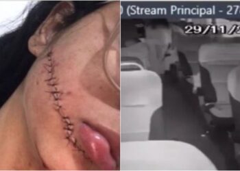 Vídeo mostra momento em que jovem tem rosto cortado dentro de ônibus; assista