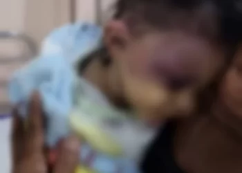 Bebê de 11 meses é espancado em Caruaru e internado em estado grave; suspeita é a madrasta