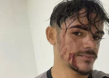 Motoboy denuncia agressão por atraso em entrega de açaí, na Paraíba