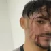 Motoboy denuncia agressão por atraso em entrega de açaí, na Paraíba