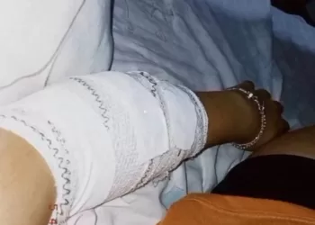 Adolescente é agredida a golpes de estilete por aluno em escola de Pernambuco