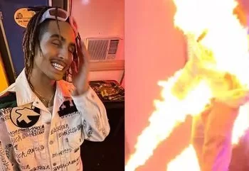 Cantor famoso é atingido por fogo durante show