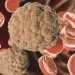 Candida auris: morre mais um paciente com o superfungo em Pernambuco; é o 3º óbito de 2023