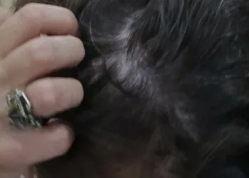 Homem é conduzido a delegacia após agredir e arrancar parte do cabelo de mulher em Afogados