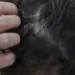 Homem é conduzido a delegacia após agredir e arrancar parte do cabelo de mulher em Afogados