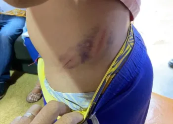 Criança de 10 anos é espancada pelo pai no interior de Pernambuco