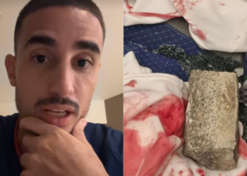 Ônibus do Fortaleza é apedrejado após empate com Sport; jogadores ficam feridos e vão para hospital