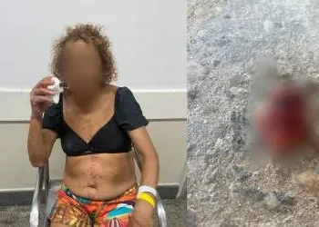 Homem arranca parte da língua da companheira durante beijo