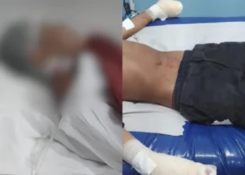 Adolescente tem dedos decepados em ‘Tribunal do Crime’ por furtar escola