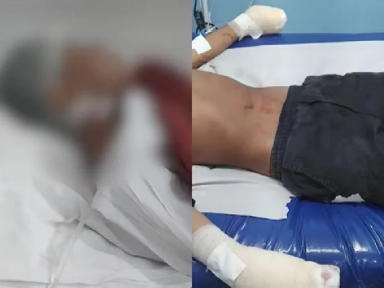 Adolescente tem dedos decepados em ‘Tribunal do Crime’ por furtar escola