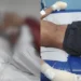 Adolescente tem dedos decepados em ‘Tribunal do Crime’ por furtar escola