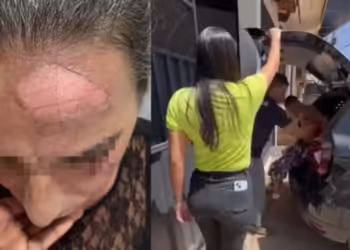 Filho joga café quente no rosto da mãe após briga por R$ 10, diz polícia