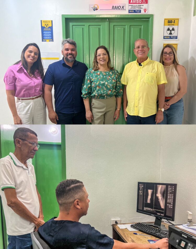 Hospital de Tuparetama moderniza exames com digitalização do Raio-X