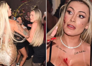 Briga entre Andressa Urach e Juju Ferrari termina em sangue, cusparada e agressão