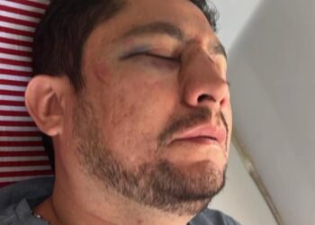 Por divergência política, professor de educação física é agredido em Carnaíba, denunciam governistas