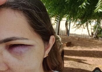 Acidente na manhã deste Sábado (15), no centro de Afogados da Ingazeira