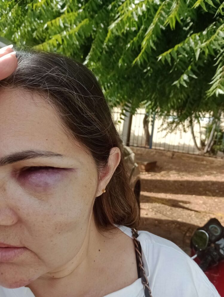 Acidente na manhã deste Sábado (15), no centro de Afogados da Ingazeira
